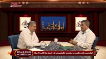 Hz. Eyyûb’ün (as) vücudundaki kurtların mahiyeti nasıldır?